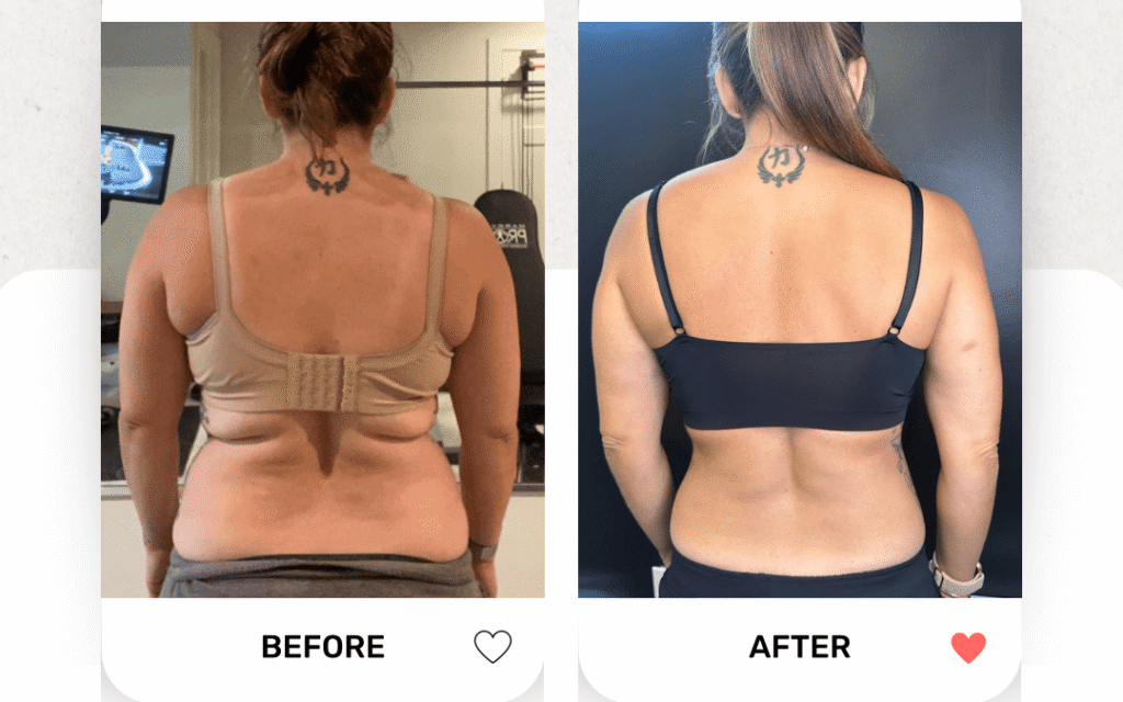 Semaglutide and tirzepatide weight loss program houston, tx